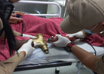 Criança de quatro anos tem parte de dedos amputados após prender mão em cilindro