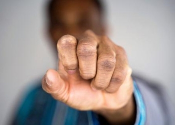 Construtora é condenada a pagar indenização ao funcionário após comentário racista do encarregado