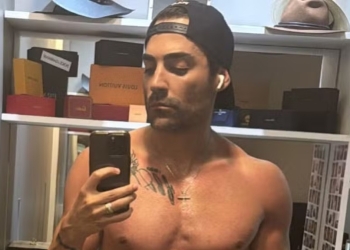 Benuto, da dupla sertaneja com Guilherme, impressiona com resultado de lipo: ‘Top’