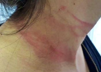 Após descobrir traição, mulher é enforcada até perder os sentidos em Cuiabá