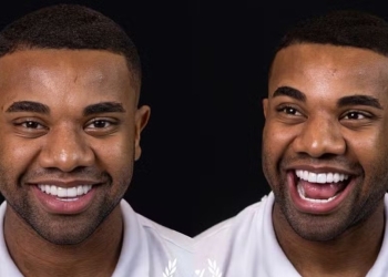 Davi Brito exibe novo sorriso após investir R$ 60 mil em procedimento: ‘Lentes novas’