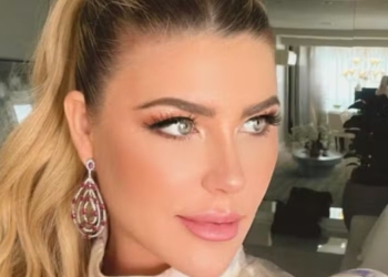 Íris Stefanelli exibe resultado de cirurgia plástica no rosto e impressiona: ‘Outra!’