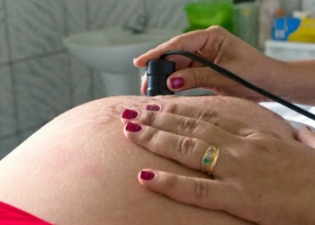 Exame pré-natal reduz chance de bebê nascer com anomalia