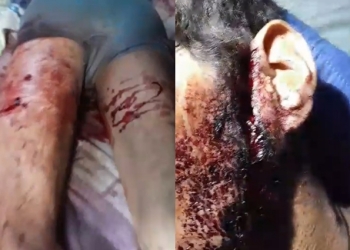 Homem é atacado por onça-pintada e fica gravemente ferido no Pantanal