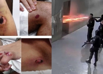 Inspeção aponta tortura, balas de borracha, spray de pimenta e negligência médica contra presos