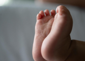 Bebê de dois meses chega morto em UPA com afundamento de crânio e pais são detidos