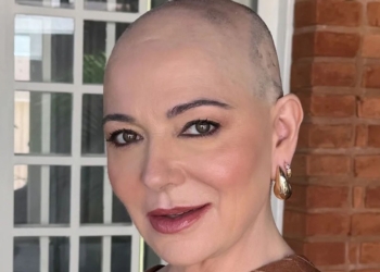 Mãe de Lucas Lucco exibe nova fase durante tratamento contra alopecia: ‘Autoestima’