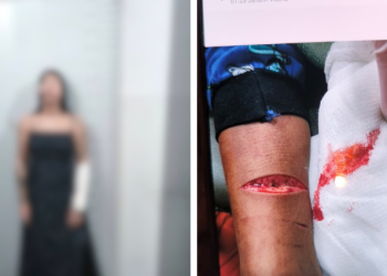 Mãe fere filho com navalha durante tentativa de suicídio em Cuiabá; criança teve cortes profundos