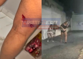 Mulher trans é baleada por cliente que não queria pagar cachê; veja vídeo