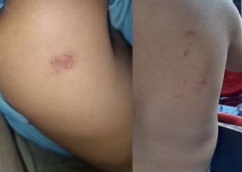 Professora é afastada após mãe usar gravador na mochila do filho