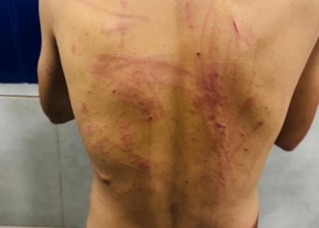 Homem é torturado com pedaços de madeira durante “salve” em MT